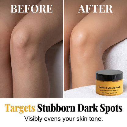 🥳 HOT SALE 2026 💞 70,000+ SOLD! Turmeric Exfoliating Body Scrub